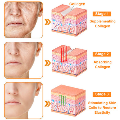 Bee Venom Skin Treatment Cream