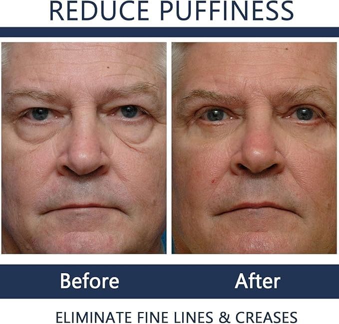 Men Eye Cream Anti Aging,Himse Awaken Peptide Depuffing Eye Gel