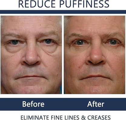 Men Eye Cream Anti Aging,Himse Awaken Peptide Depuffing Eye Gel