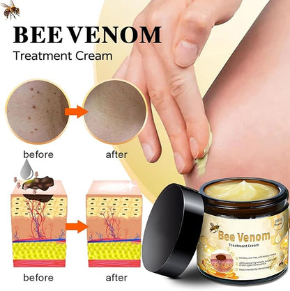 Bee Venom Skin Treatment Cream